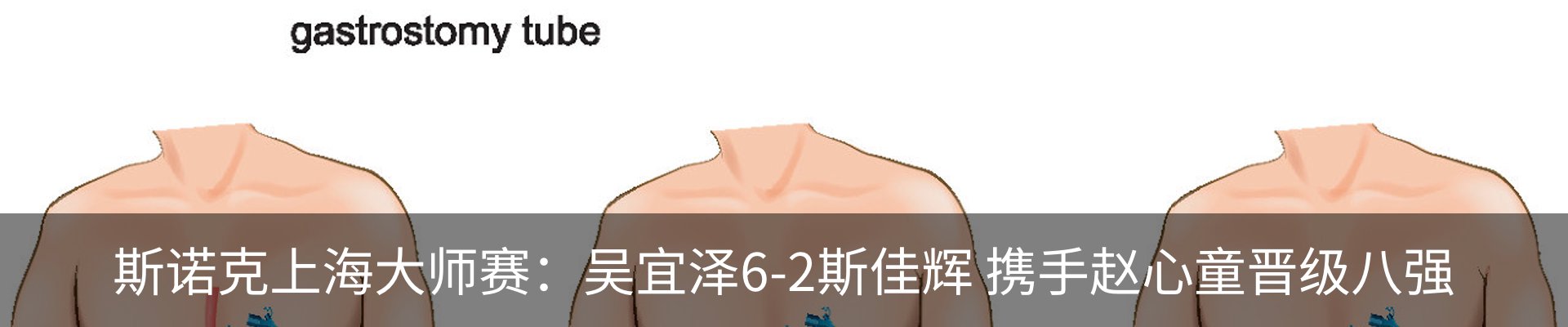 资讯中心